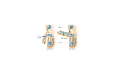 Erectile Dysfunction