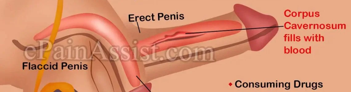 What is Erectile Dysfunction